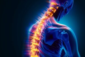 D9bf801f 8e98 43c3 a956 be1079086b49 exploring the long-term impact of spinal cord injuries bergel magence llp 3
